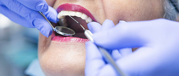 Best Emergency Gum Treatment in Lighthouse Point, FL
